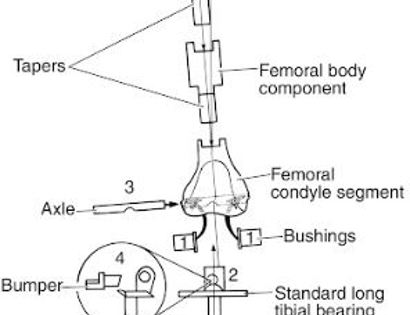 Distal Femur Components Schematic