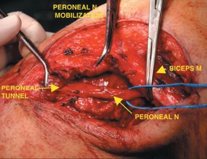 Dissection 