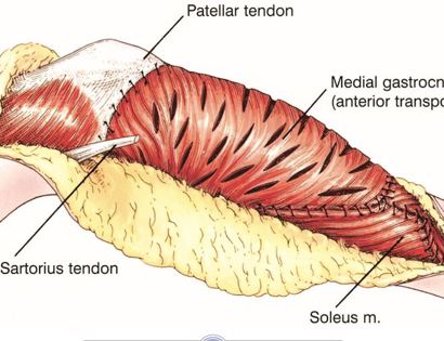 Fascia