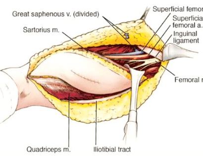 Blood Vessel and Nerve Dissection 