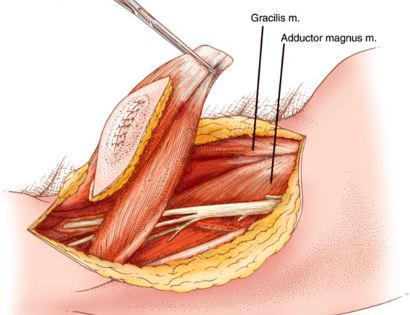 Muscle Releases