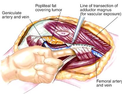 Muscle Releases