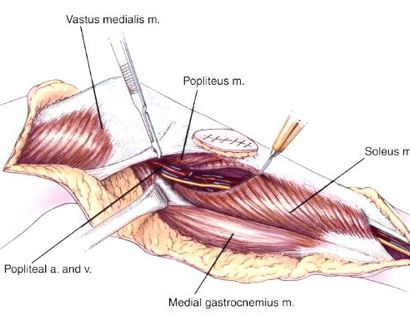 Muscle Releases 