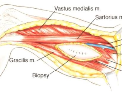 Blood Vessel and Nerve Dissection