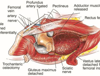 Muscle Releases