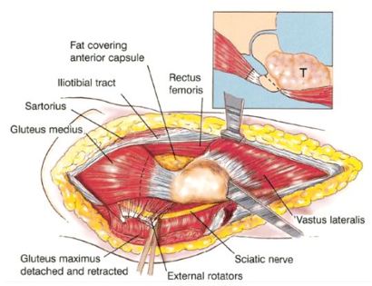 Blood Vessel and Nerve Dissection 