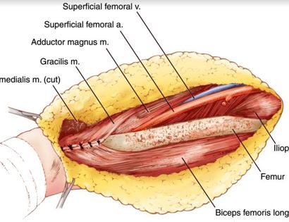 Soft Tissue Reconstruction 