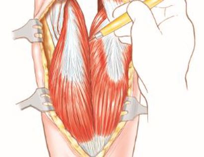 popliteal fossa muscle releases 