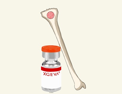 Bone Strengthening Medications