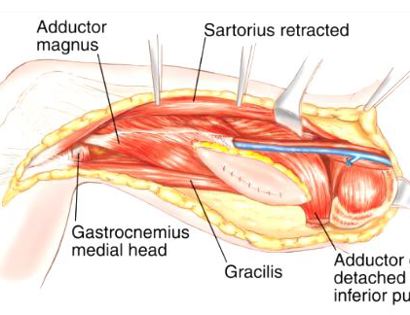 Muscle Releases